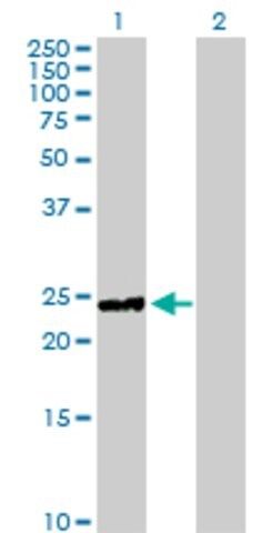 Anti-HYAL1 antibody produced in rabbit