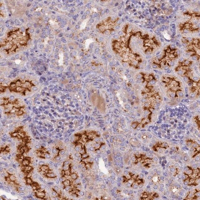 Anti-HYKK antibody produced in rabbit