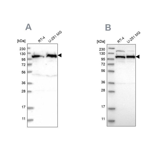 Anti-IARS2 antibody produced in rabbit