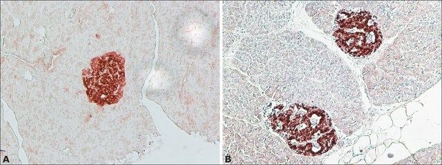 Anti-IAPP (N-terminal) antibody produced in rabbit