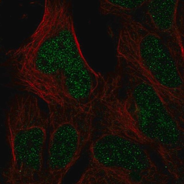 Anti-HUS1B antibody produced in rabbit