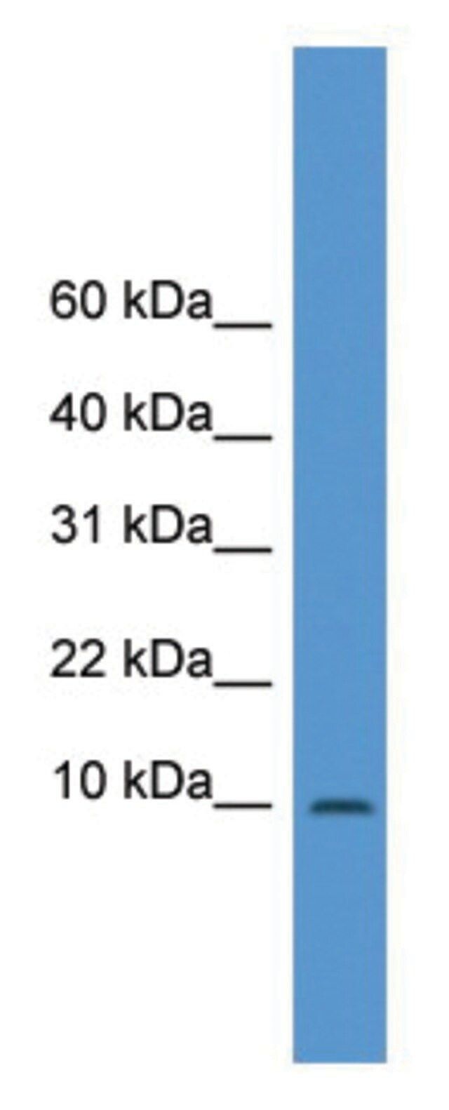 Anti-IAPP (N-terminal) antibody produced in rabbit