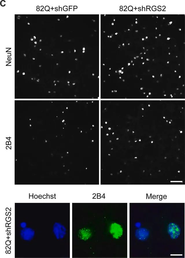 Anti-Huntingtin Antibody, a.a. 1-82