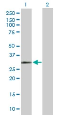 Anti-HUS1 antibody produced in rabbit