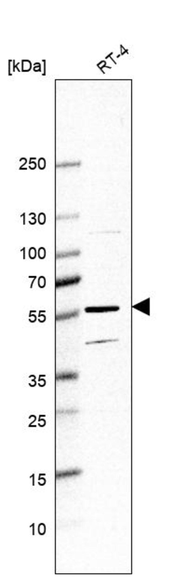 Anti-HYAL4 antibody produced in rabbit