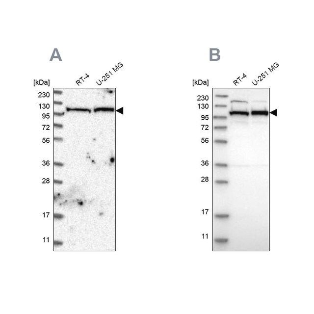 Anti-IARS2 antibody produced in rabbit