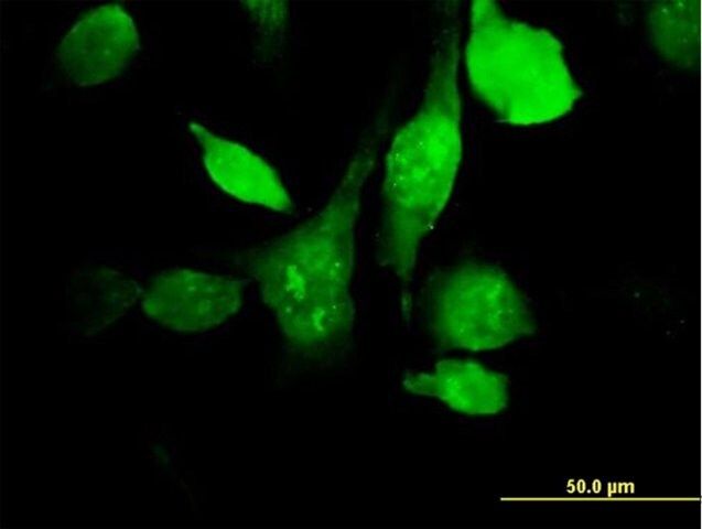 Anti-HYAL3 antibody produced in mouse