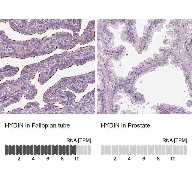 Anti-HYDIN antibody produced in rabbit