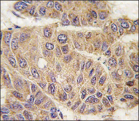 Anti-IARS (N-term) antibody produced in rabbit