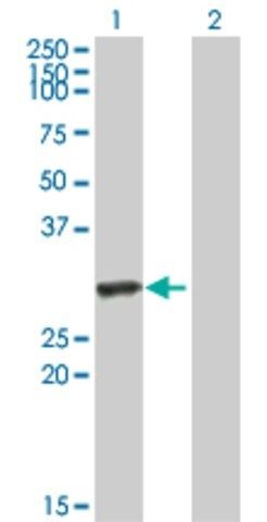 Anti-HYAL1 antibody produced in mouse