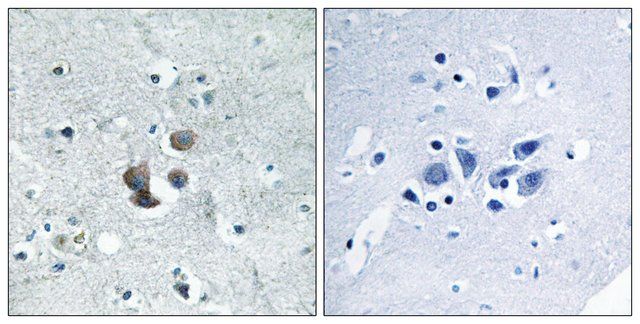 Anti-IBP7 antibody produced in rabbit