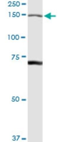 Anti-IARS antibody produced in rabbit