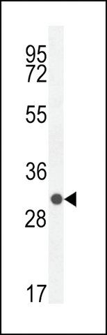 ANTI-IDDM12(N-TERMINAL) antibody produced in rabbit