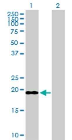 Anti-ICT1 antibody produced in rabbit