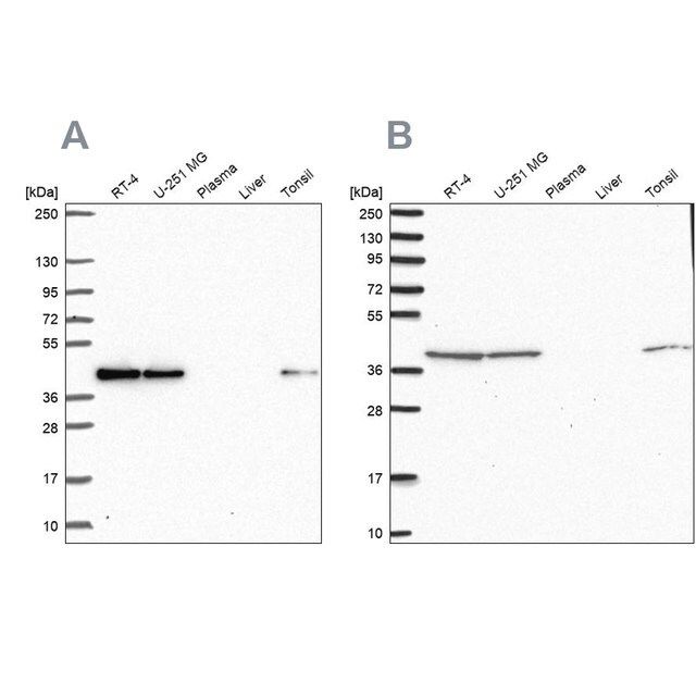 Anti-IDH3B antibody produced in rabbit