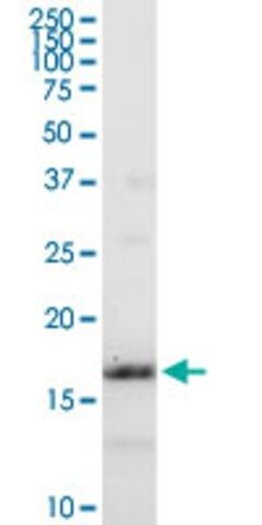 Anti-IFITM3 antibody produced in rabbit