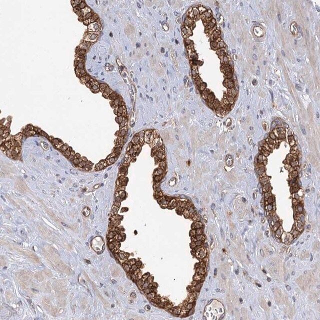 Anti-IDI1 antibody produced in rabbit