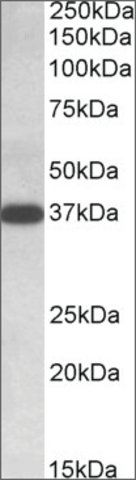 Anti-IDH3A (C-terminal) antibody produced in goat