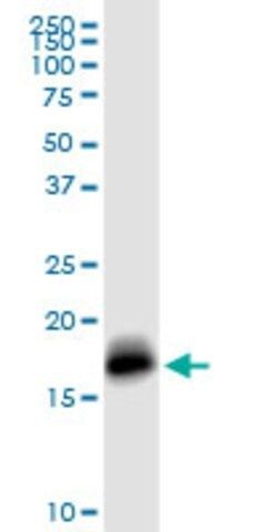 Anti-IFITM3 antibody produced in rabbit