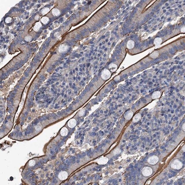 Anti-IFITM5 antibody produced in rabbit