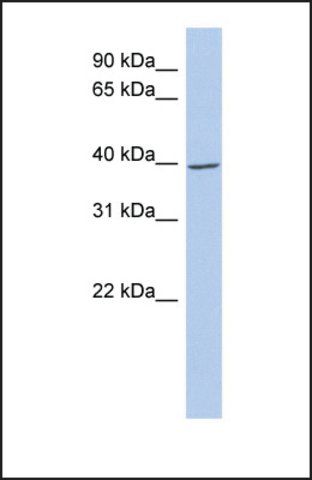 Anti-IKBKG, (N-terminal) antibody produced in rabbit