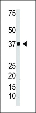 ANTI-IKB ALPHA (IKBA) antibody produced in rabbit