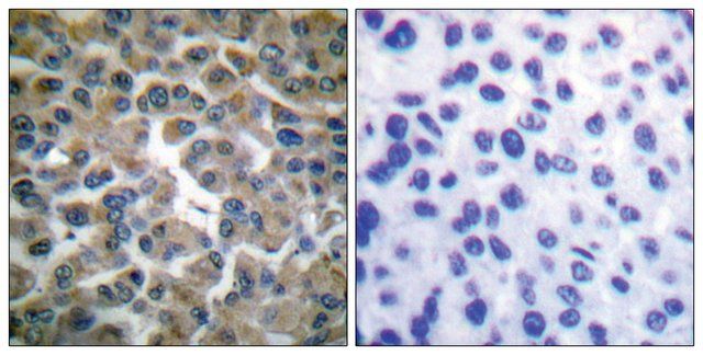 Anti-IB- antibody produced in rabbit