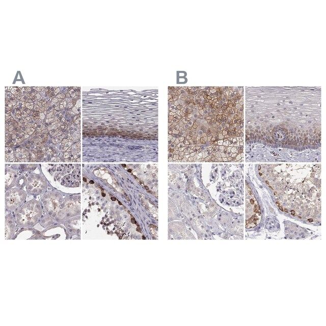 Anti-HSP90AB1 antibody produced in rabbit