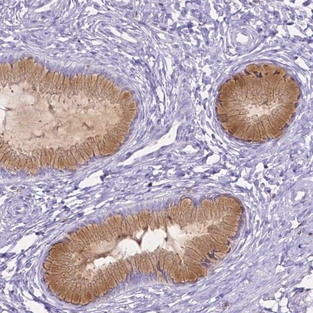 Anti-HSPA12A antibody produced in rabbit