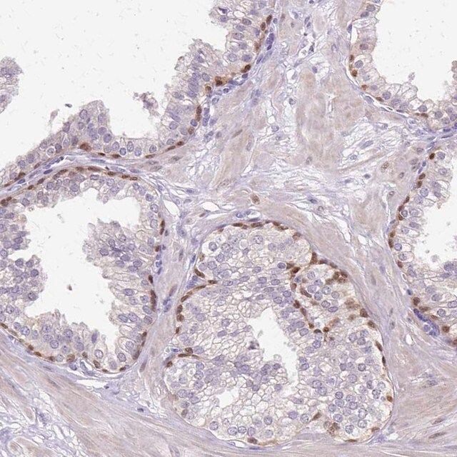 Anti-HSPA1A antibody produced in rabbit