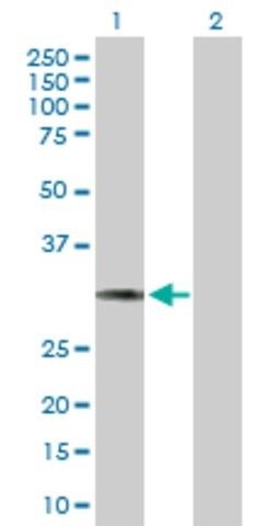 Anti-HCCS antibody produced in mouse