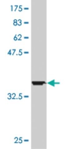 ANTI-HD antibody produced in mouse