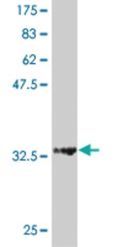 ANTI-HD antibody produced in mouse