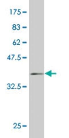 ANTI-HD antibody produced in mouse