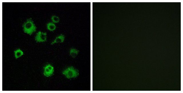 Anti-HCRTR1 antibody produced in rabbit