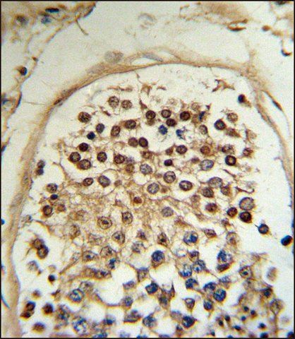 ANTI-HCCA2 (N-TERM) antibody produced in rabbit