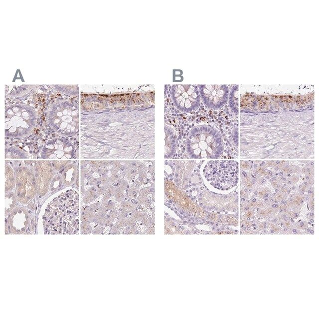 Anti-HEXB antibody produced in rabbit