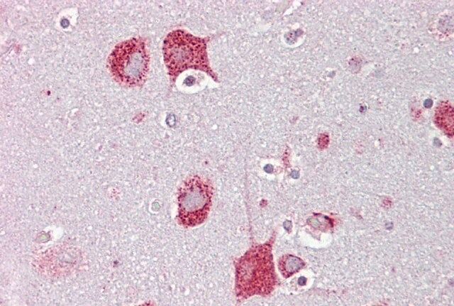 Anti-HEXA (C-terminal) antibody produced in rabbit