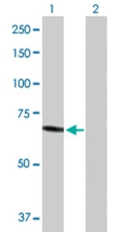 Anti-HEXA antibody produced in rabbit