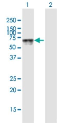 Anti-HEXA antibody produced in mouse