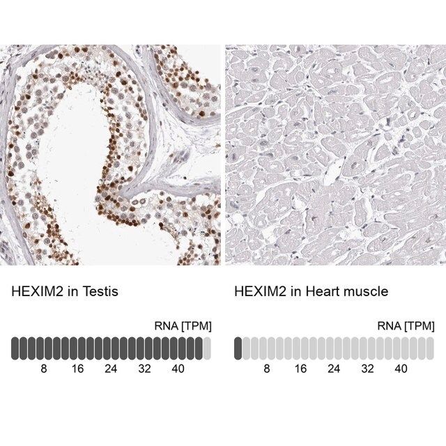 Anti-HEXIM2 antibody produced in rabbit