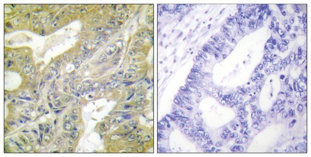 Anti-HEXB antibody produced in rabbit