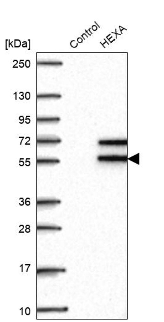 Anti-HEXA antibody produced in rabbit