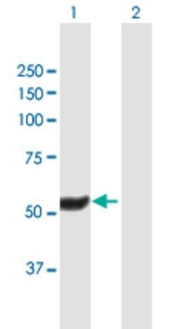 Anti-HEXDC antibody produced in mouse