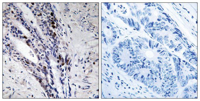 Anti-Histone H2A antibody produced in rabbit