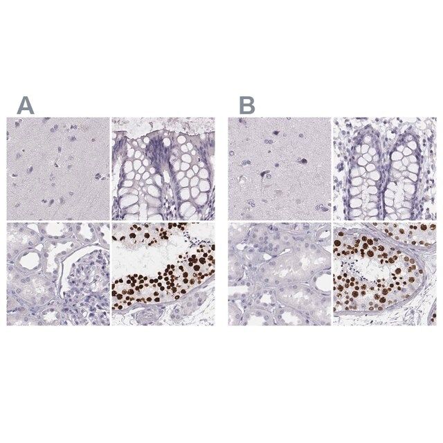 Anti-HIST1H1T antibody produced in rabbit