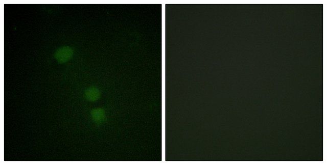 Anti-Histone H2B (Acetyl-Lys<sup>15</sup>) antibody produced in rabbit