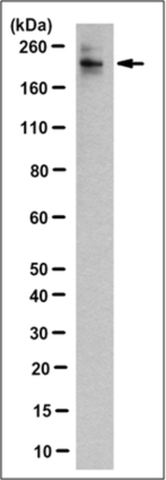 Anti-Histone Demethylase JARID1C Antibody, clone 2B4.2