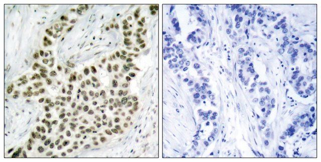 Anti-Histone H2A.X antibody produced in rabbit