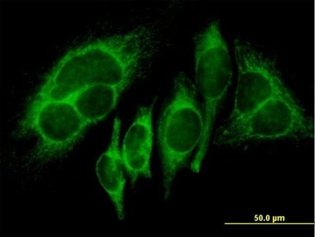 Anti-HK1 antibody produced in mouse